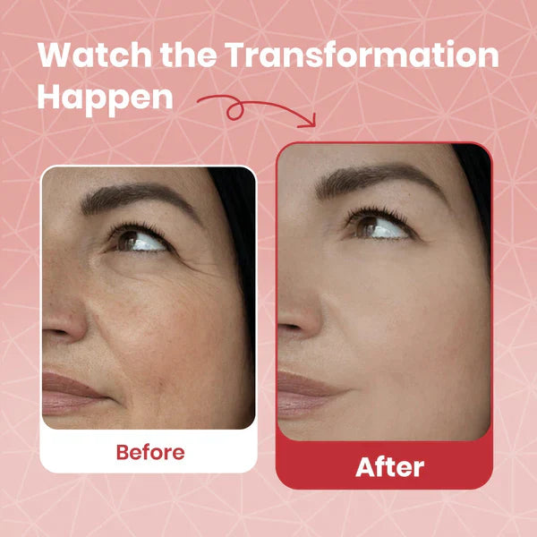 🔥 Limited-time 60% OFF today 🔥 Centella Asiatica Cream (All-In-One)