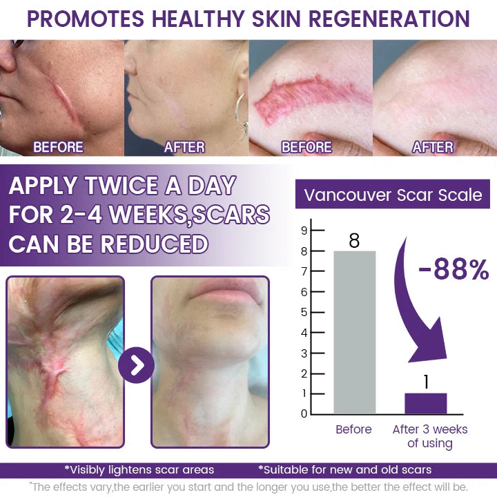 Neyeros® ReGenScar Stem Cell Scar Gel