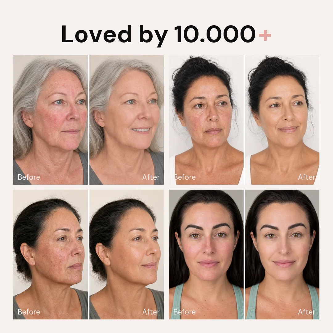 Limited time sale🔥Korean Blemish Balm