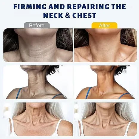Roller Massage Neck Cream 🧴 Collagen & Hyaluronic Acid | Firms Neck, Reduces Wrinkles & Double Chin