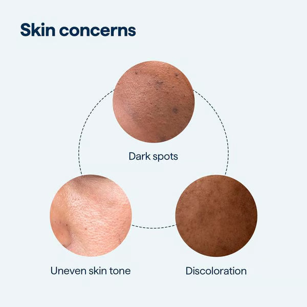 🧴Last Day Promotion 49% OFF- ✨ REMEDY for Dark Spots - All-in-One Nightly Serum for Fading Dark Spots & Evening Skin Tone with Retinol, Kojic Acid & Tranexamic Acid