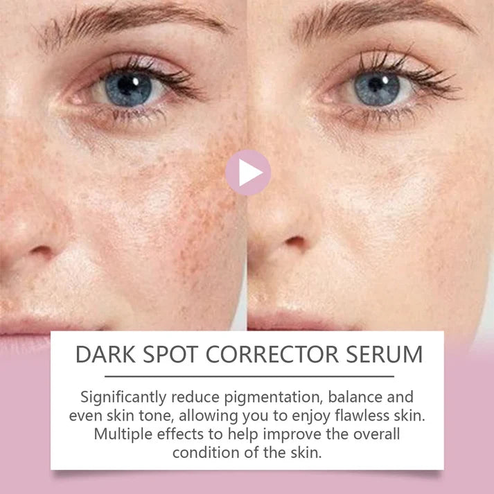🔥Limited Time Offer🔥Advanced Dark Spot Corrector Serum -Multi-Correction Brightening Formulafor Sun Spots, Age Spots, and Melasma-XXS