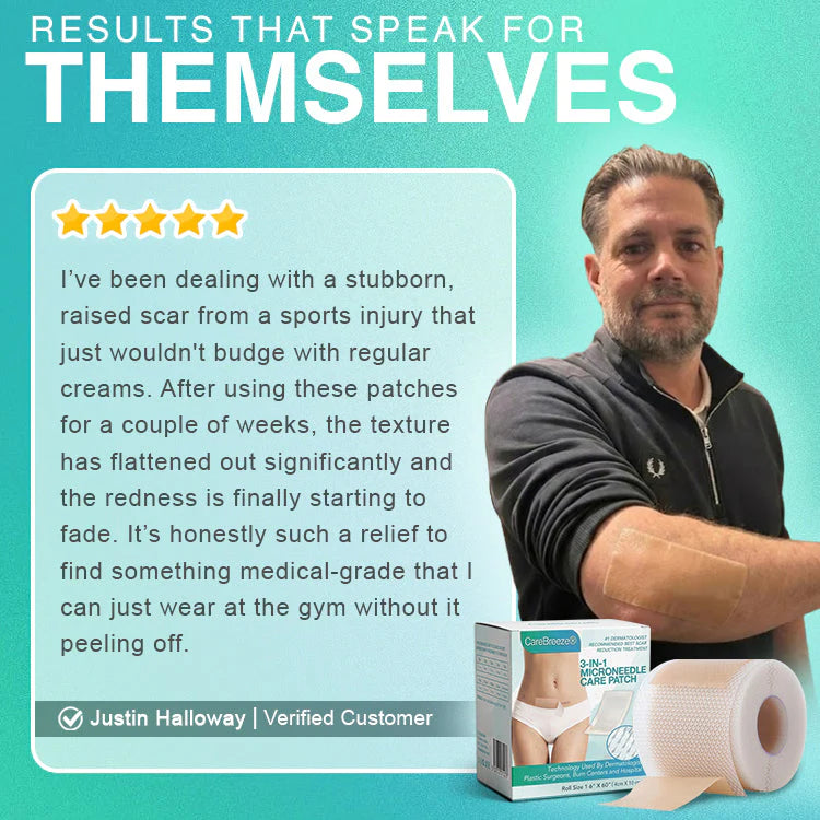 CareBreeze 3-in-1ScarRemoval Microneedle Care Patch
