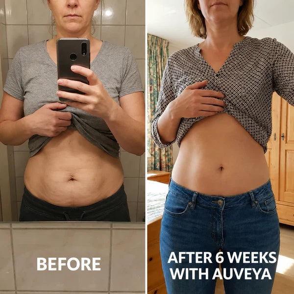 Auveya® BodySculpt