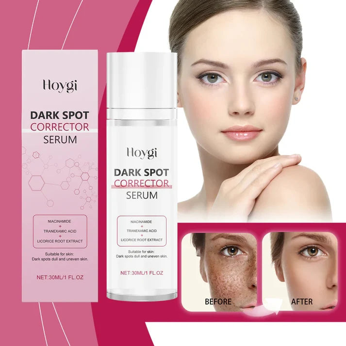 🔥Limited Time Offer🔥Advanced Dark Spot Corrector Serum -Multi-Correction Brightening Formulafor Sun Spots, Age Spots, and Melasma-XXS