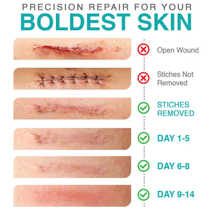 CareBreeze 3-in-1ScarRemoval Microneedle Care Patch