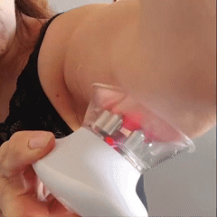 Auveya® BodySculpt