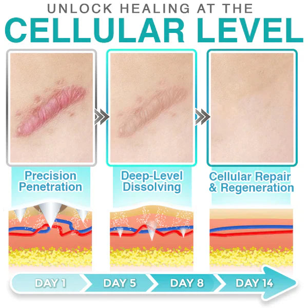 CareBreeze 3-in-1ScarRemoval Microneedle Care Patch