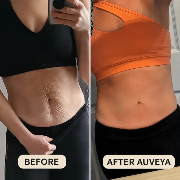 Auveya® BodySculpt